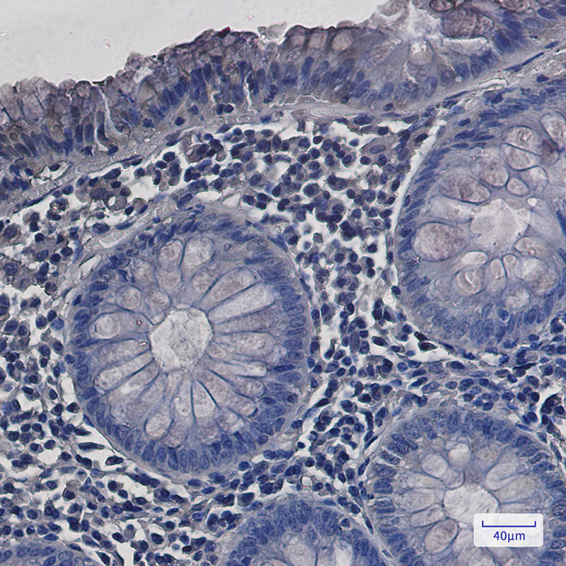 Anti-SDHA Rabbit Monoclonal Antibody