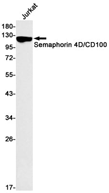 Anti-Semaphorin 4D Rabbit Monoclonal Antibody