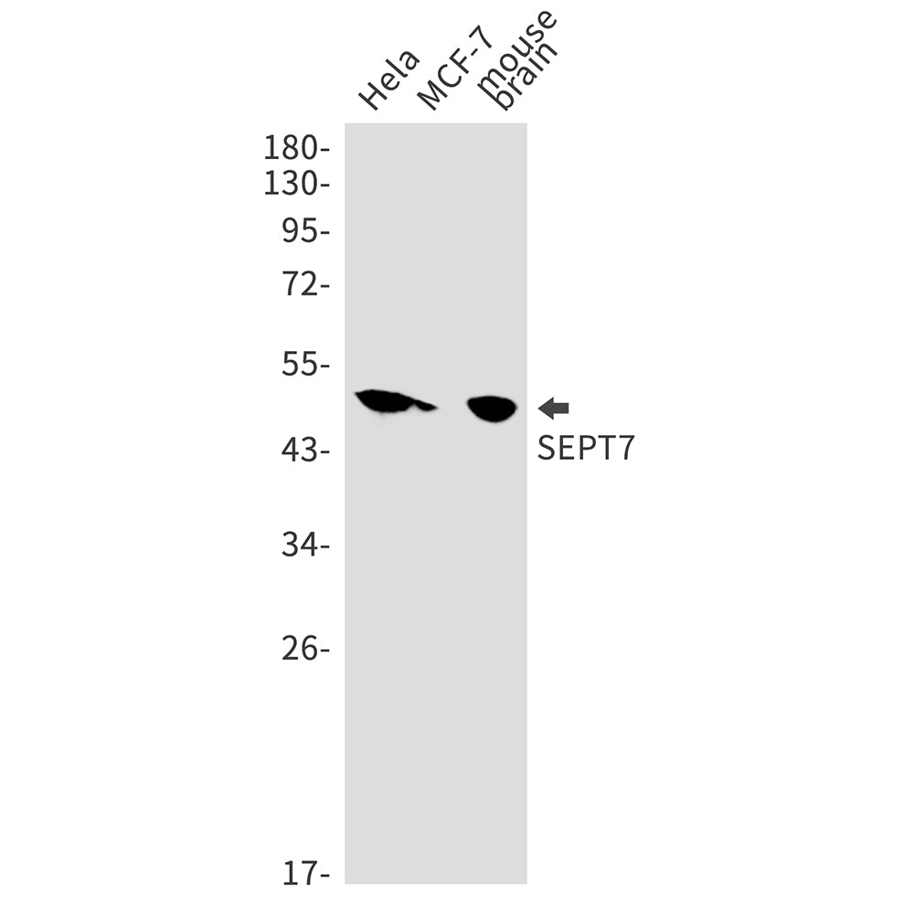 Anti-Septin 7 Rabbit Monoclonal Antibody