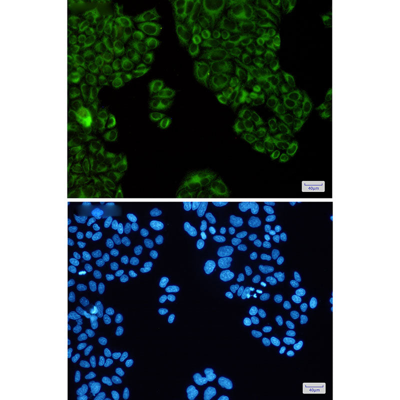 Anti-SERCA2 ATPase Rabbit Monoclonal Antibody