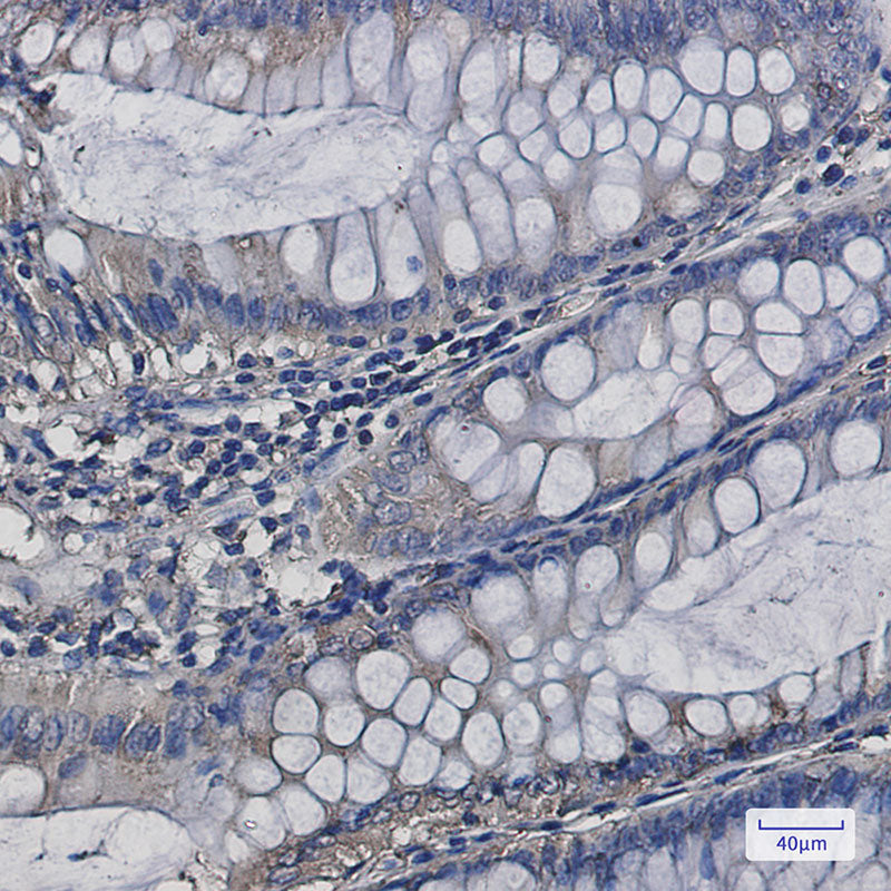 Anti-SERCA2 ATPase Rabbit Monoclonal Antibody