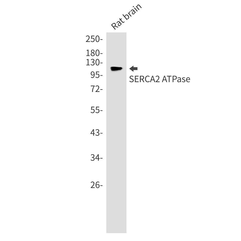 Anti-SERCA2 ATPase Rabbit Monoclonal Antibody