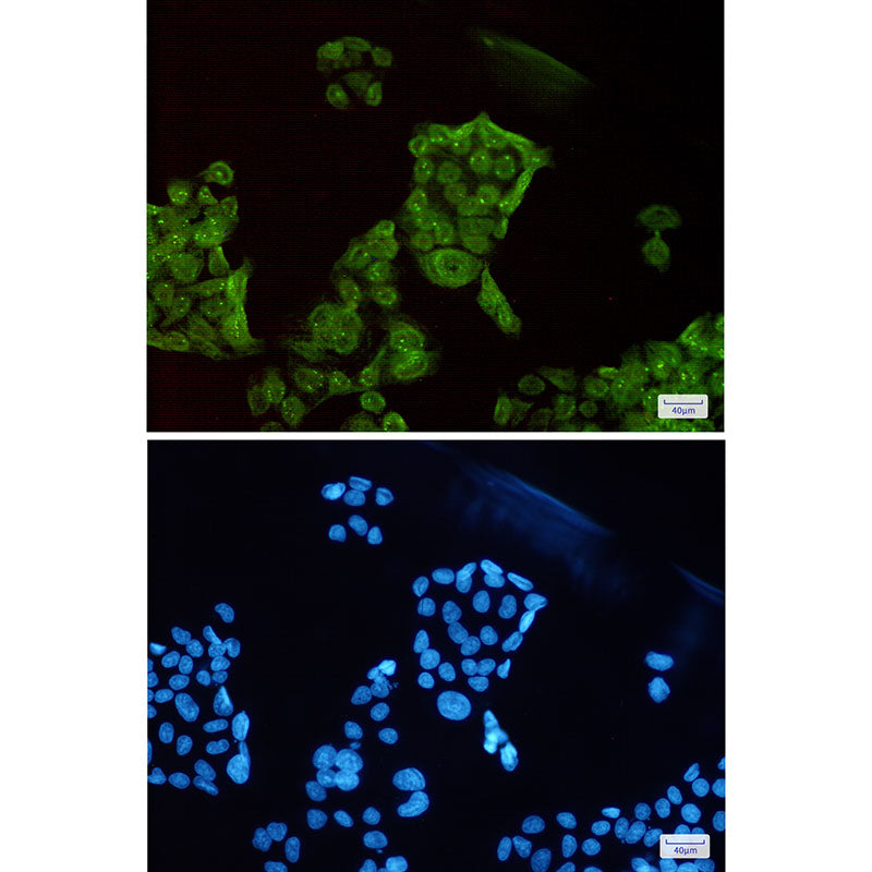 Anti-SET Rabbit Monoclonal Antibody