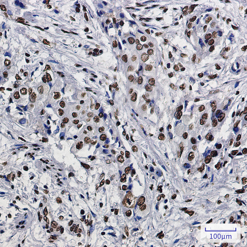 Anti-SET Rabbit Monoclonal Antibody