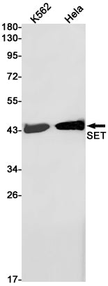 Anti-SET Rabbit Monoclonal Antibody