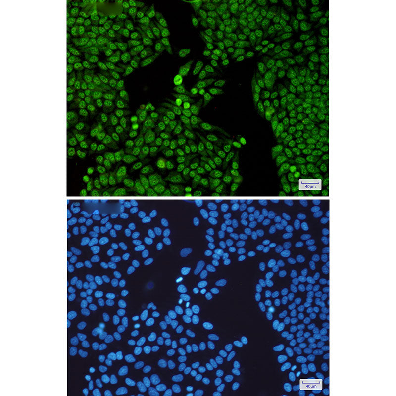Anti-SF3B3 Rabbit Monoclonal Antibody