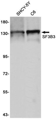 Anti-SF3B3 Rabbit Monoclonal Antibody