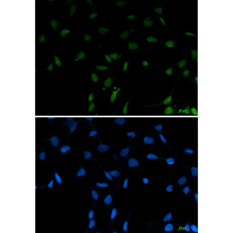 Anti-SFPQ Rabbit Monoclonal Antibody