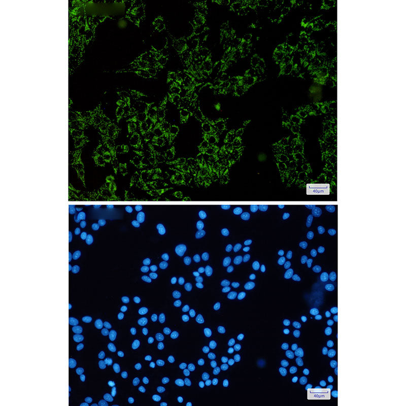 Anti-SGSM1 Rabbit Monoclonal Antibody