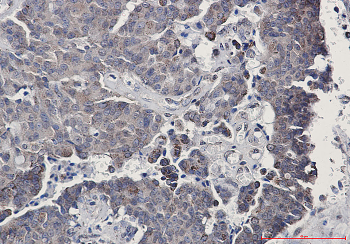 Anti-SIRT3 Rabbit Monoclonal Antibody