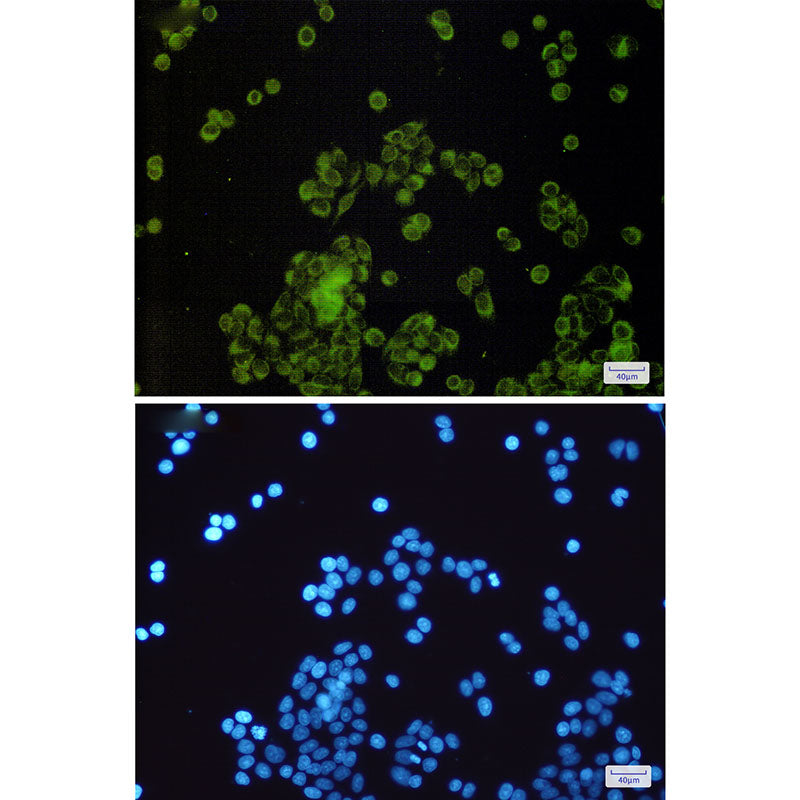 Anti-SLC27A4 Rabbit Monoclonal Antibody