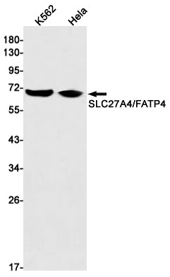 Anti-SLC27A4 Rabbit Monoclonal Antibody