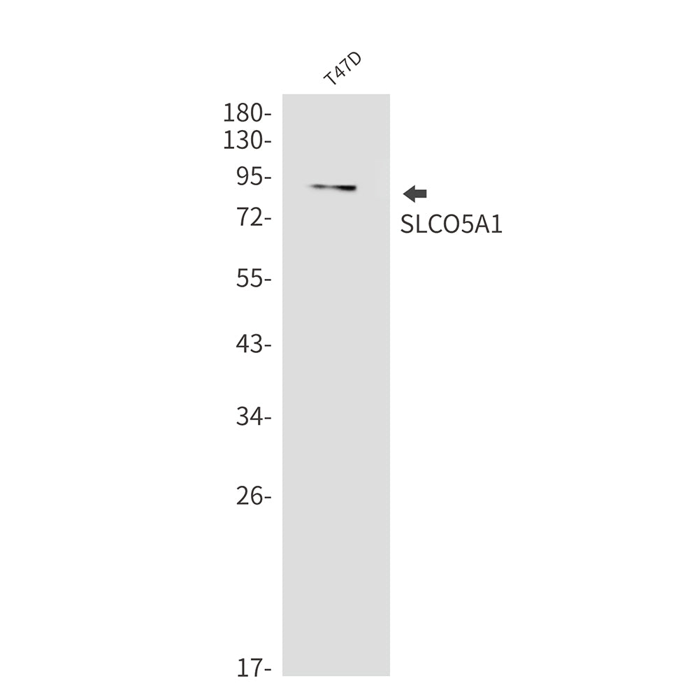 Anti-SLCO5A1 Rabbit Monoclonal Antibody