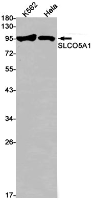 Anti-SLCO5A1 Rabbit Monoclonal Antibody