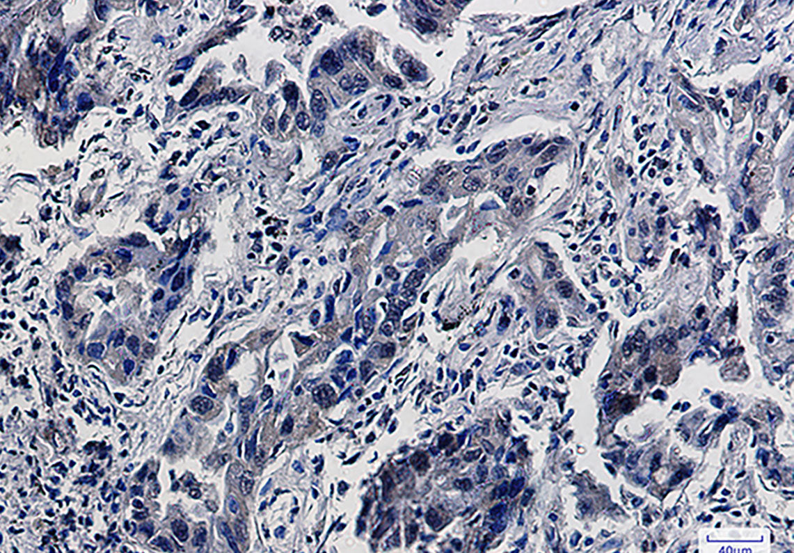Anti-Smad5 Rabbit Monoclonal Antibody