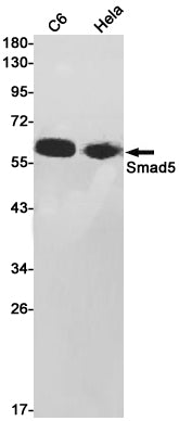 Anti-Smad5 Rabbit Monoclonal Antibody
