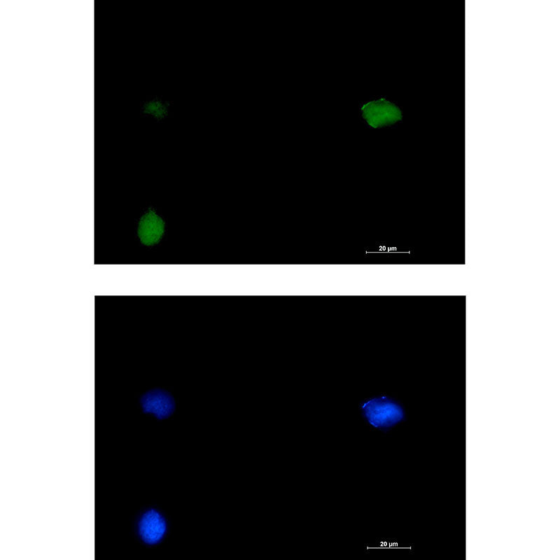 Anti-SMARCC1 Rabbit Monoclonal Antibody
