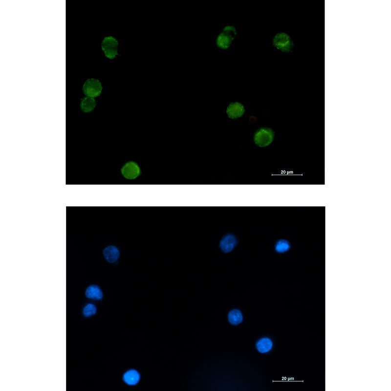 Anti-SMYD3 Rabbit Monoclonal Antibody