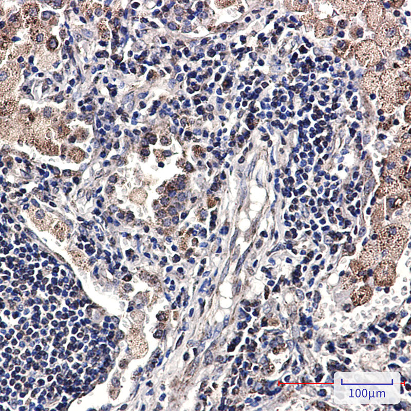 Anti-SMYD3 Rabbit Monoclonal Antibody