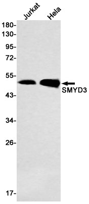 Anti-SMYD3 Rabbit Monoclonal Antibody