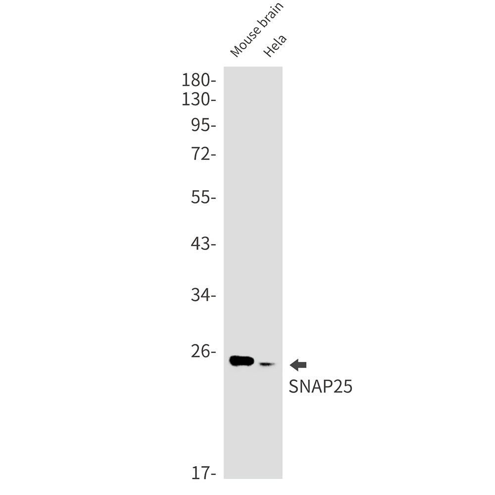 Anti-SNAP25 Rabbit Monoclonal Antibody