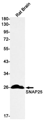 Anti-SNAP25 Rabbit Monoclonal Antibody