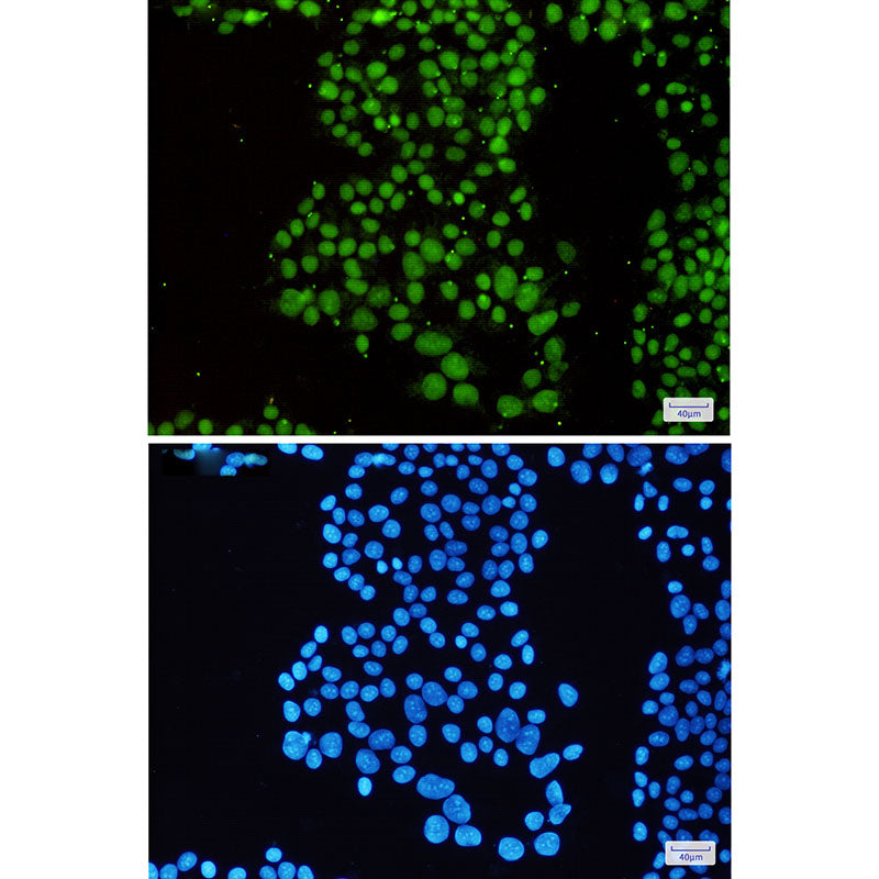 Anti-SMARCB1 Rabbit Monoclonal Antibody