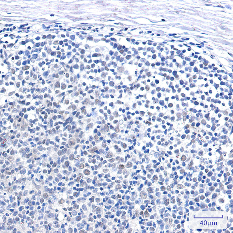 Anti-SMARCB1 Rabbit Monoclonal Antibody