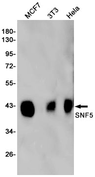 Anti-SMARCB1 Rabbit Monoclonal Antibody