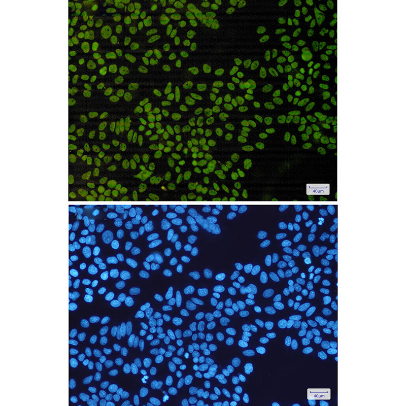 Anti-SMARCB1 Rabbit Monoclonal Antibody