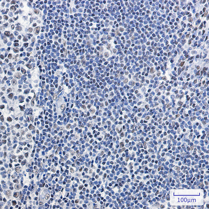 Anti-SMARCB1 Rabbit Monoclonal Antibody