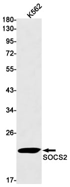 Anti-SOCS2 Rabbit Monoclonal Antibody