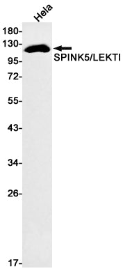 Anti-SPINK5 Rabbit Monoclonal Antibody