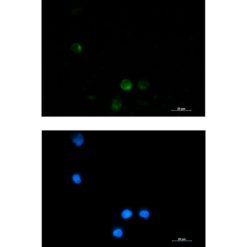 Anti-SSX2IP Rabbit Monoclonal Antibody