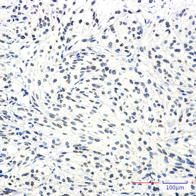 Anti-SSX2IP Rabbit Monoclonal Antibody