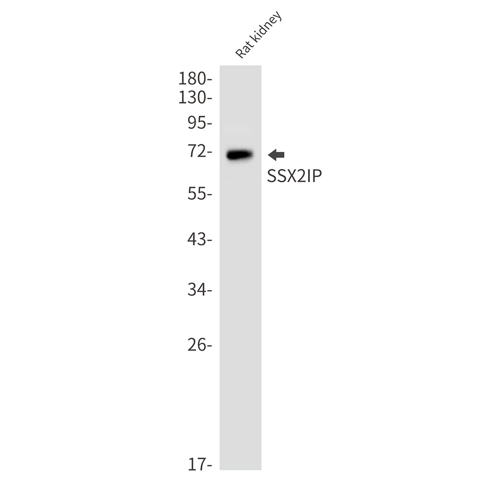 Anti-SSX2IP Rabbit Monoclonal Antibody