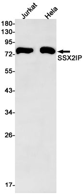 Anti-SSX2IP Rabbit Monoclonal Antibody