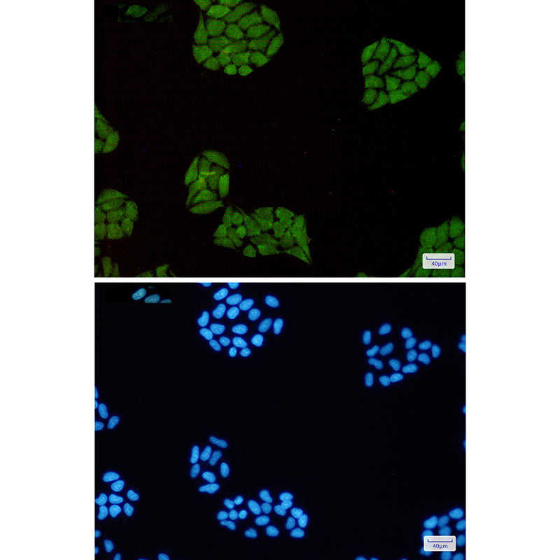 Anti-STAT1 Rabbit Monoclonal Antibody