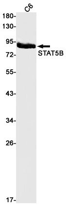 Anti-STAT5b Rabbit Monoclonal Antibody
