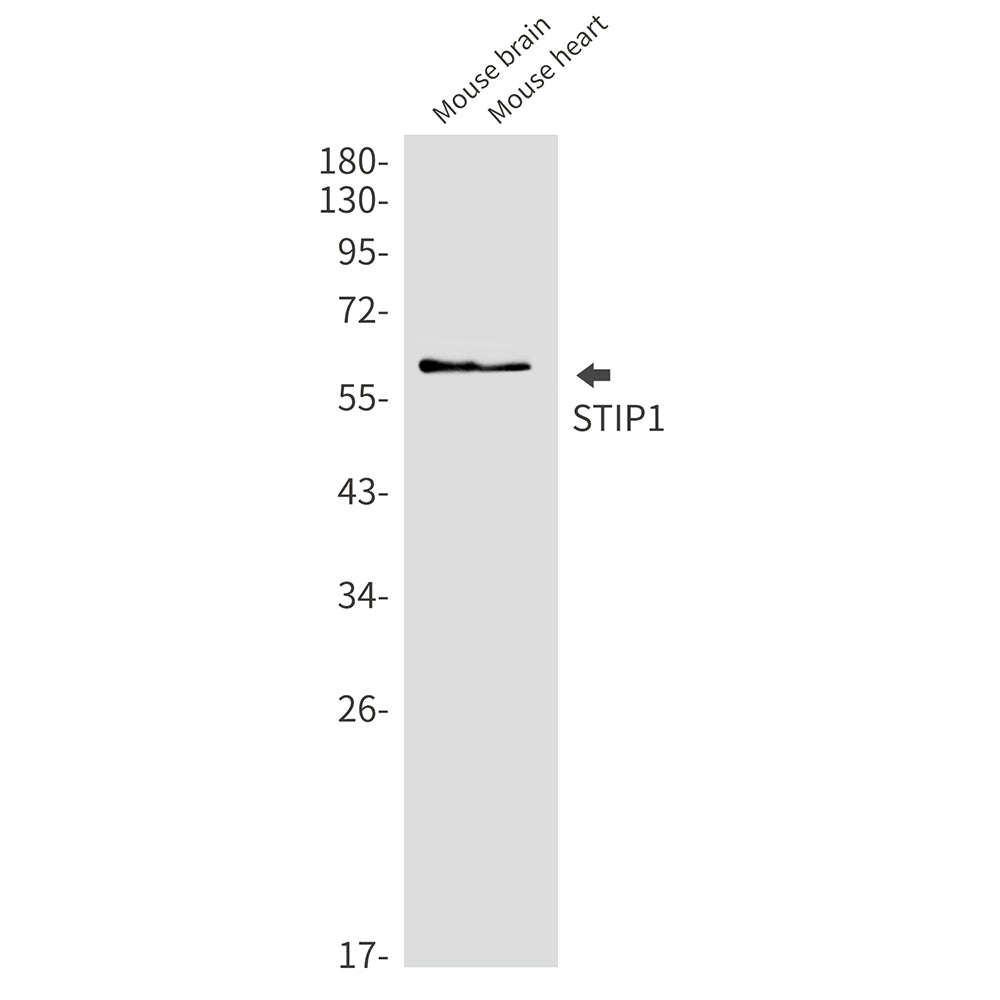 Anti-STIP1 Rabbit Monoclonal Antibody