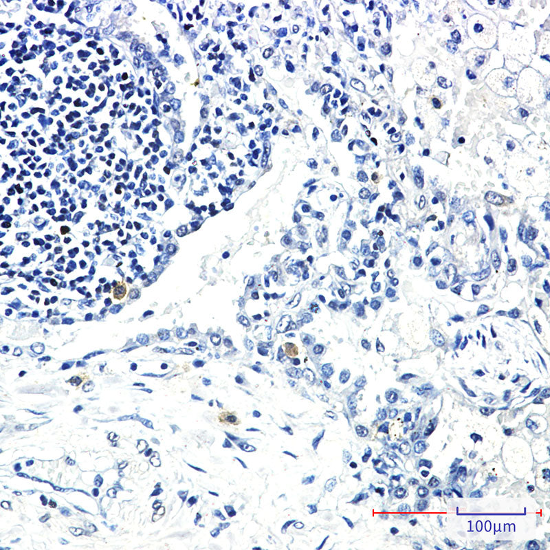 Anti-STK3 Rabbit Monoclonal Antibody