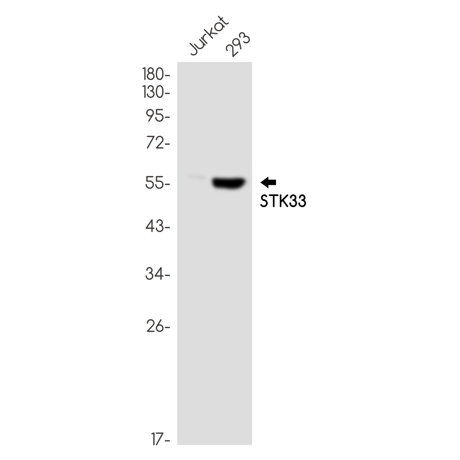 Anti-STK33 Rabbit Monoclonal Antibody