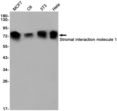 Anti-Stromal Interaction Molecule 1 Rabbit Monoclonal Antibody