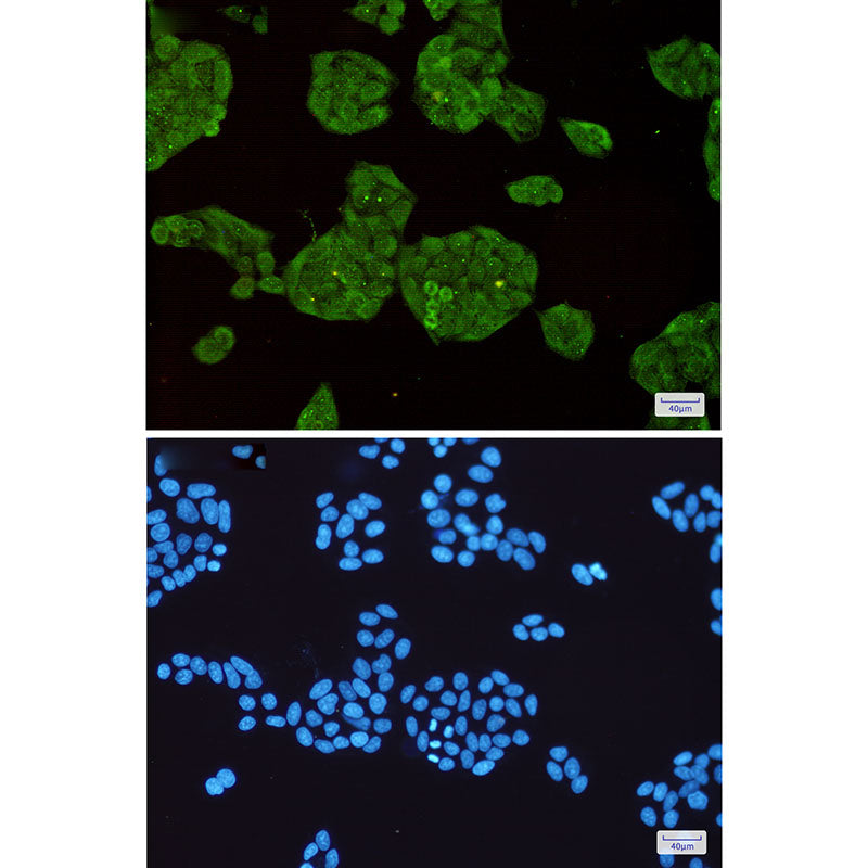 Anti-STUB1 Rabbit Monoclonal Antibody