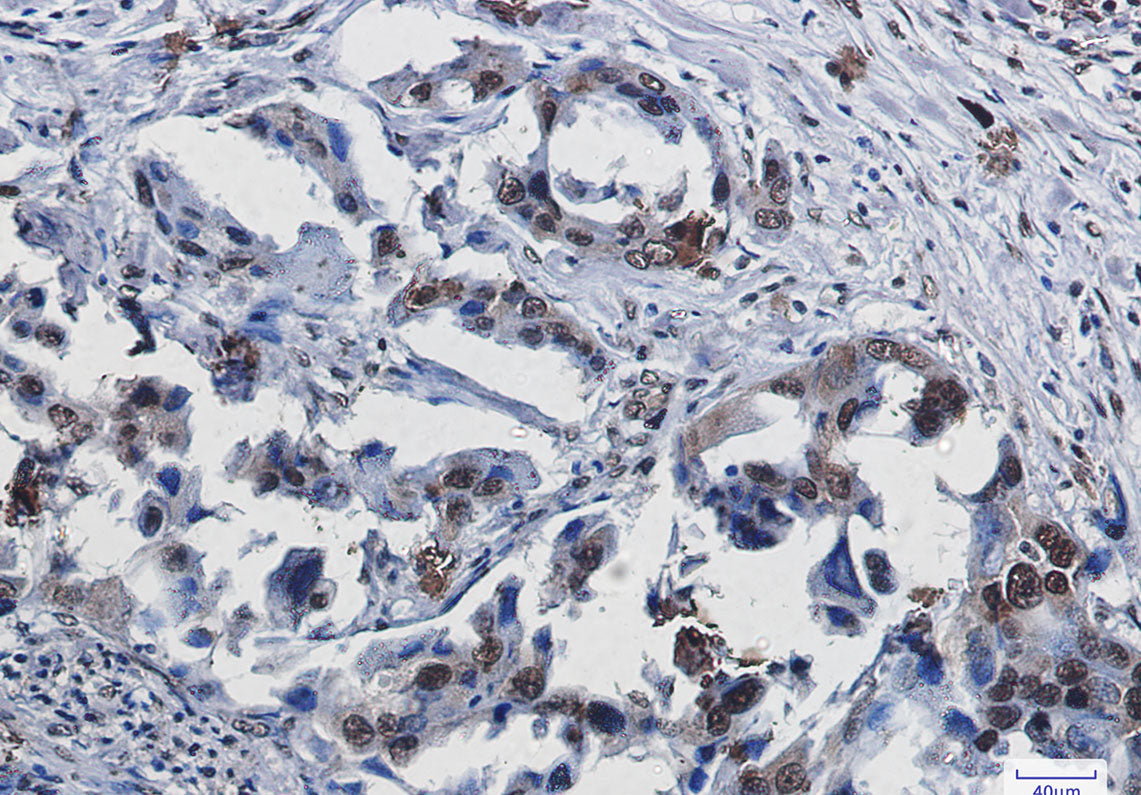 Anti-SUMO1 Rabbit Monoclonal Antibody