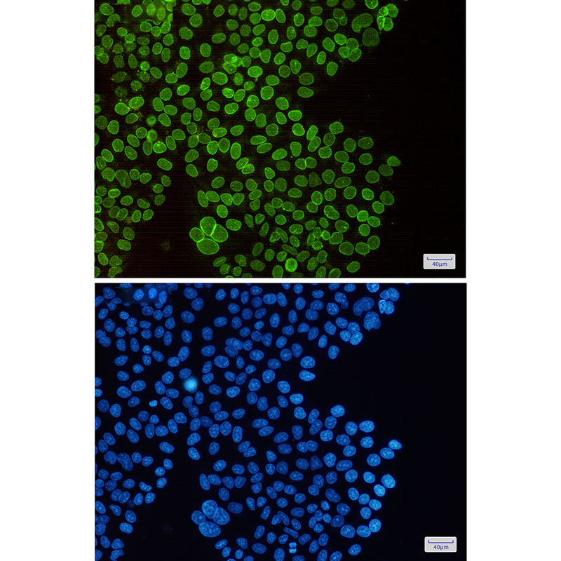 Anti-SUN1 Rabbit Monoclonal Antibody