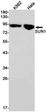 Anti-SUN1 Rabbit Monoclonal Antibody