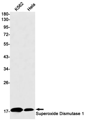 Anti-Superoxide Dismutase 1 Rabbit Monoclonal Antibody