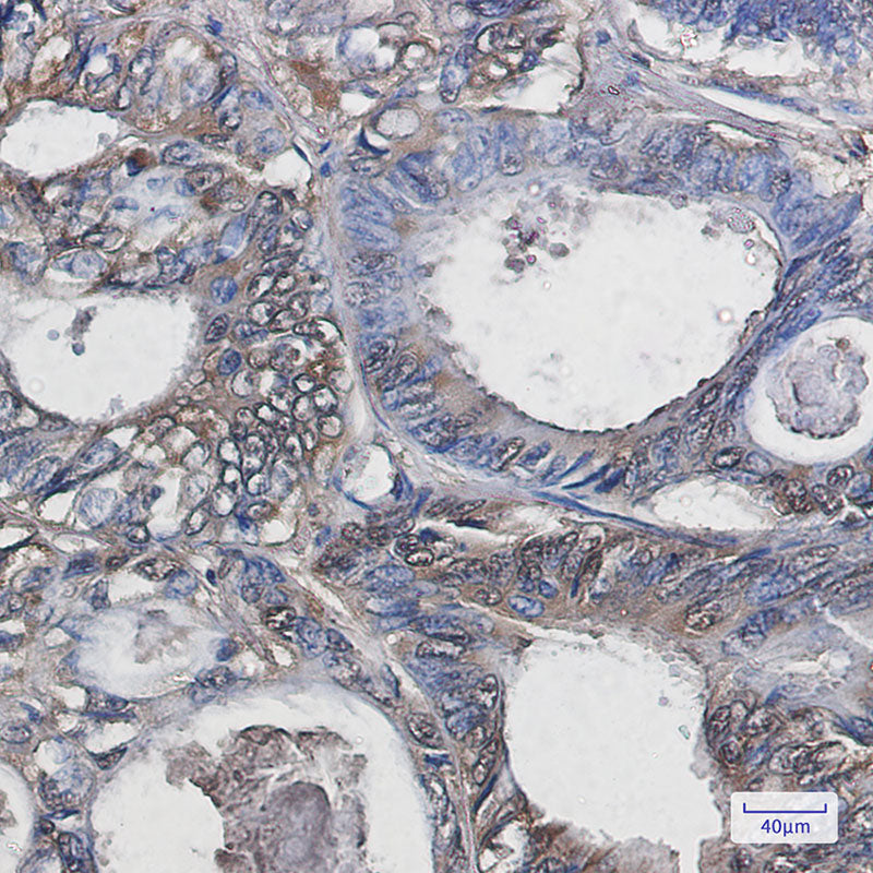 Anti-Superoxide Dismutase 1 Rabbit Monoclonal Antibody