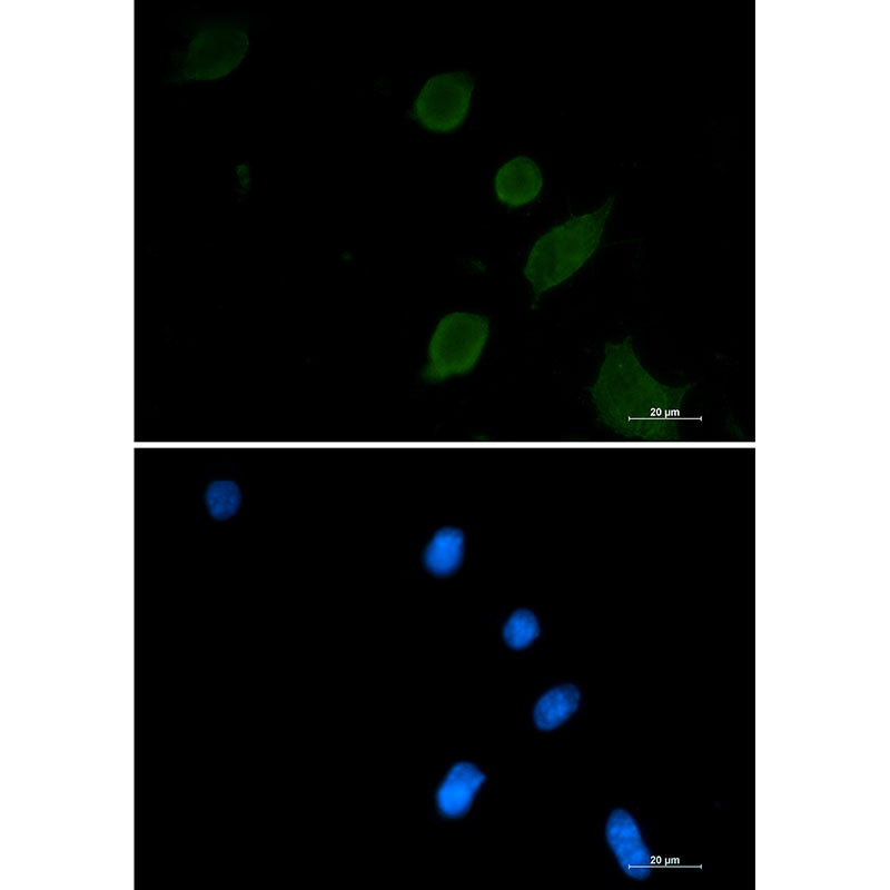 Anti-Synaptophysin Rabbit Monoclonal Antibody